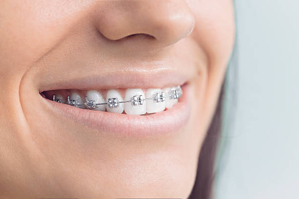 Best Wisdom Tooth Removal  in Frazeysburg, OH